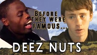Deez Nuts - Before They Were Famous