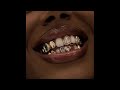 FREE FOR PROFIT Melodic Type Beat Different