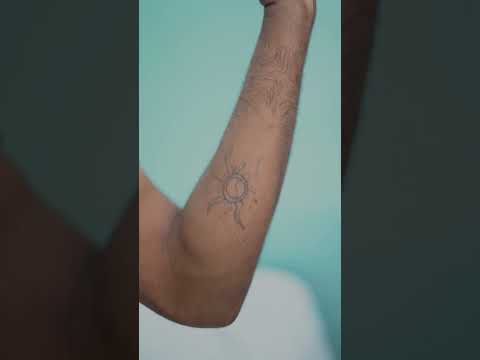 Get Your old Tattoo Removed At 