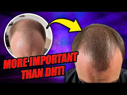 Does DHT Cause Hair Loss? - The Actual Truth