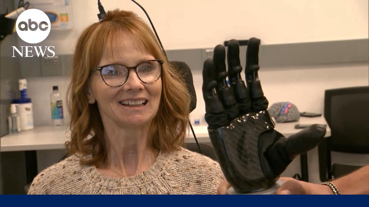 Touch Breakthrough: New Prosthetics Change Everything!