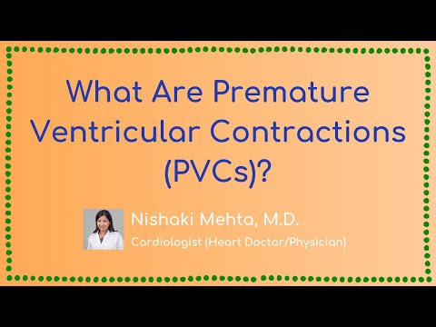 What Are Premature Ventricular Contractions (PVCs)?