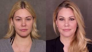 How Supermodel Shanna Moakler Keeps Her Face Looking Young