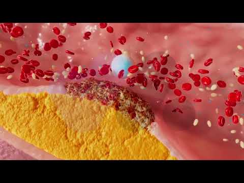 Medical Animation