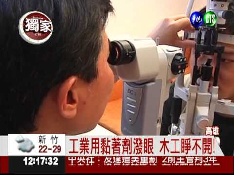 三秒膠潑濺 木工眼睛黏住了!