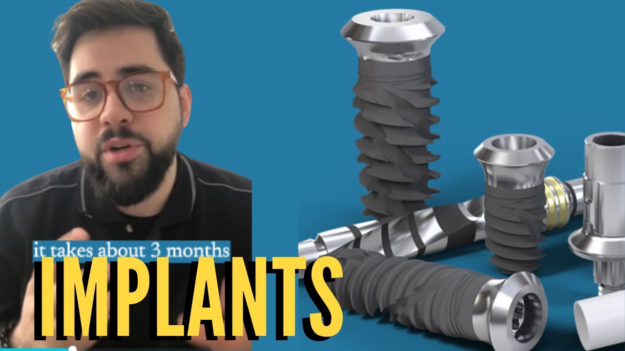 Everything about dental implants