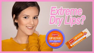 O'Keeffee's Lip Repair Saved My Extremely Dry Cracked  Lips