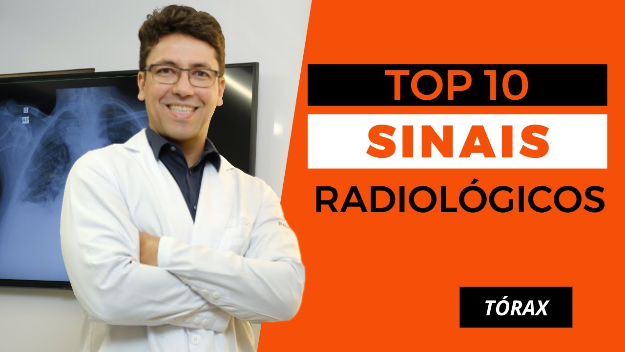 TOP 10 SINAIS RADIOLÓGICOS