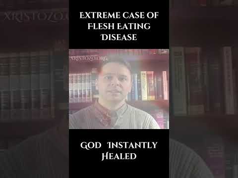 Instant Healing Saved from Amputation