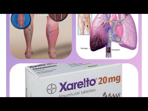 Xarelto 20 Mg Rivaroxaban Tablets US, UK