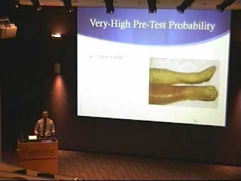 A Strategy for using D-Dimer in the Diagnosis of Thomboembolic Disease