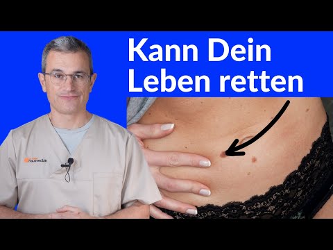Das sollte jeder über Hautkrebs wissen: Erkennen und Behandeln. Dr. Kasten in Mainz #hautkrebs