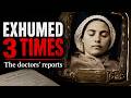 St. Bernadette Exhumed 3 Times — What the Doctors Wrote in Their Reports