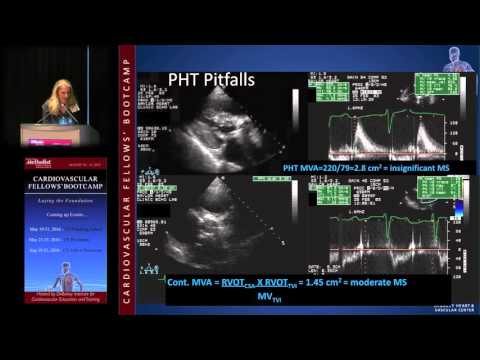 Mitral Stenosis (Karla Kurrelmeyer, MD)