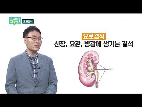 2021/06/04 TV닥터처방전 - 소변길 막는 요로결석
