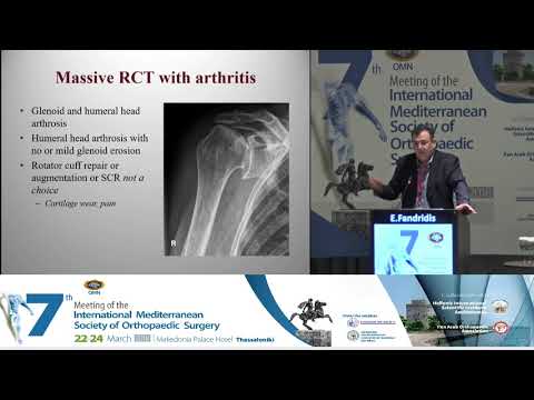 Em Fandridis - Massive RC tear and arthroplasty options