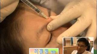 【国民】 韓国 低い鼻を10分で高くするプチ整形が人気 【総整形】