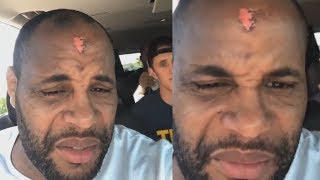 Daniel Cormier | Training camp sucks!!! | Fights Derrick Lewis at UFC 230