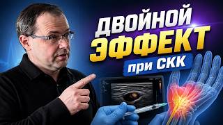 Синдром карпального канала
