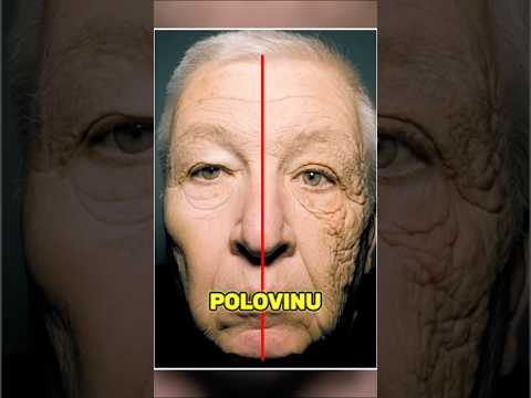 Řidič Kamionu Zestárl Jen Na Jedné Straně Obličeje #shorts