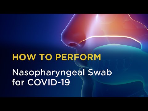 Nasopharyngeal Swab for COVID-19