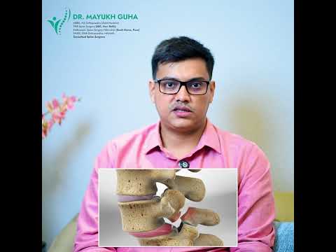 Do You Really Need Screws in Spine Surgery?