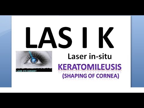 Ophthalmology LASIK Laser in situ KeratoMileusis C Custmoized Femto Epi E CF