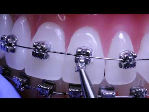 REINSERIMENTO SPORTELLO H4