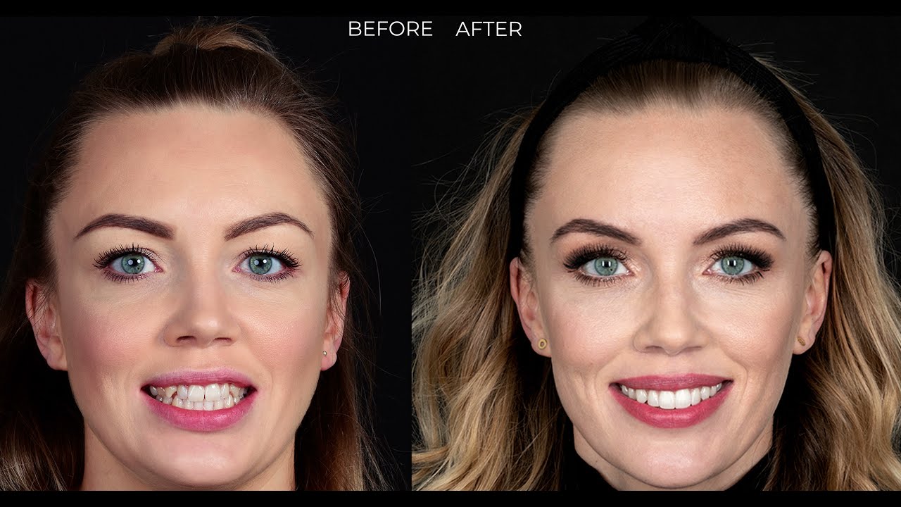 Metamorfoza uśmiegu Patrycji