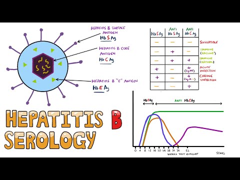 Understanding Wilson s Disease Hepatolenticular Degeneration