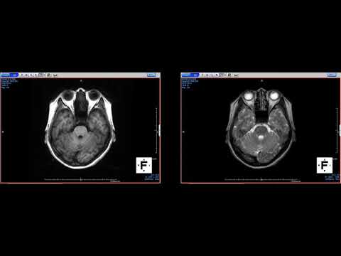 【医学部保健学科】人体のCTやMRIの画像を見てみよう！