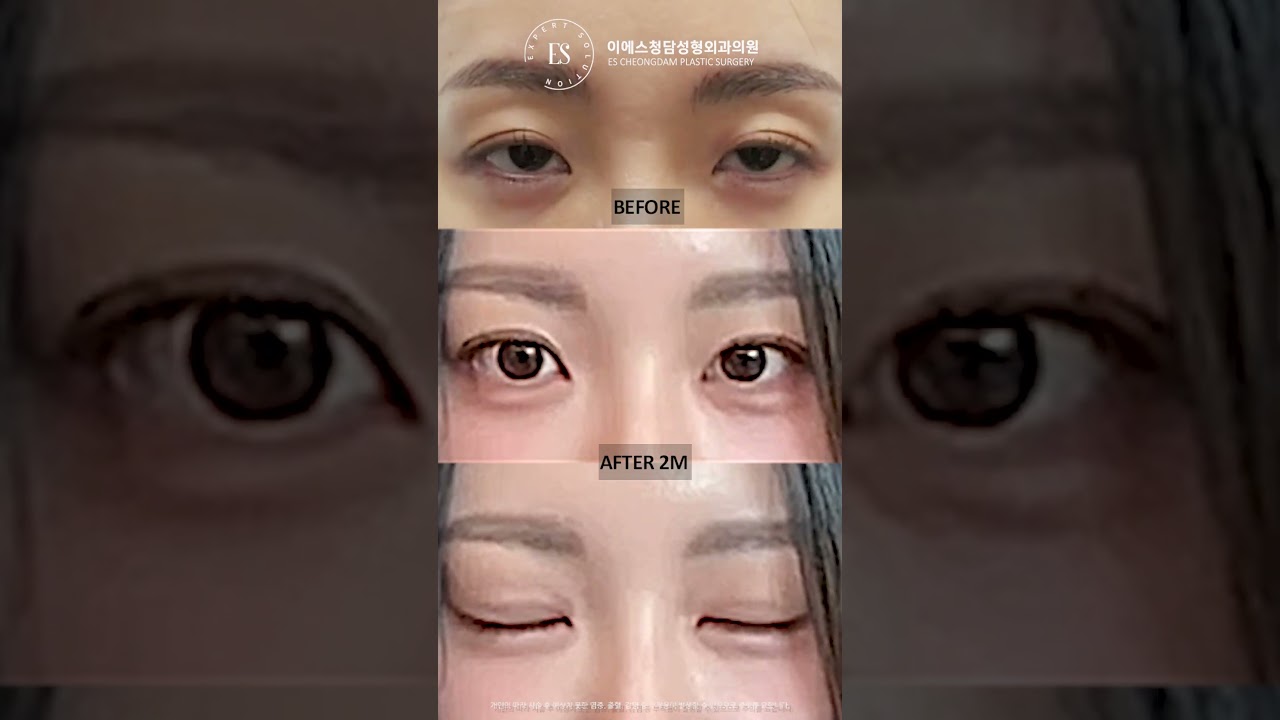 이에스 유튜브
