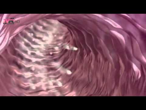 Këshilla mjekësore - A është aspirina një ilaç që bën mrekulli?