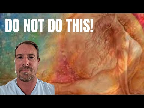 The Dangers Of Yoga And Meditation! WARNING!