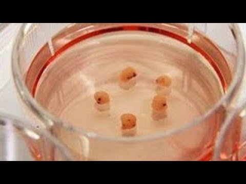 Lab-grown ‘mini brains’ helping us dementia treatment