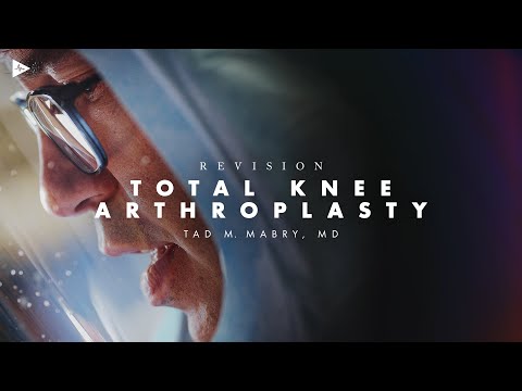 Revision Total Knee Arthroplasty for Aseptic Loosening | Preview