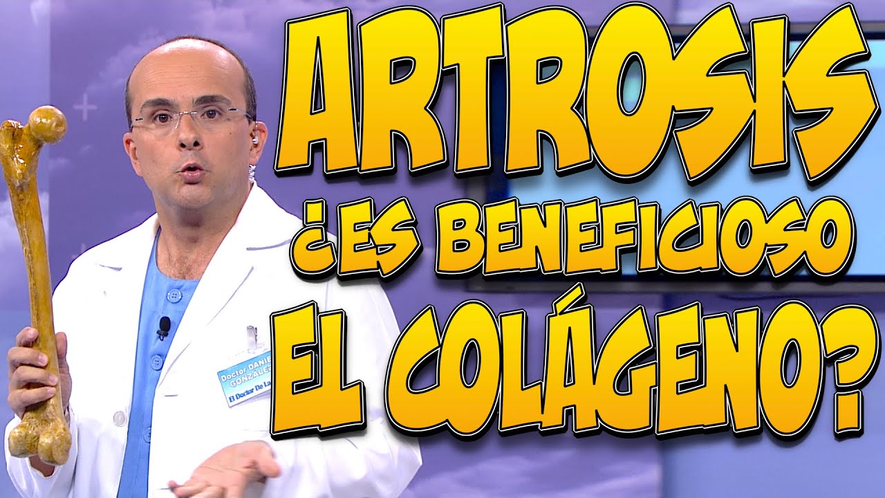 Watch Para la ARTROSIS, ¿es BENEFICIOSO el COLÁGENO Now Para la ARTROSIS, ¿es BENEFICIOSO el COLÁGENO