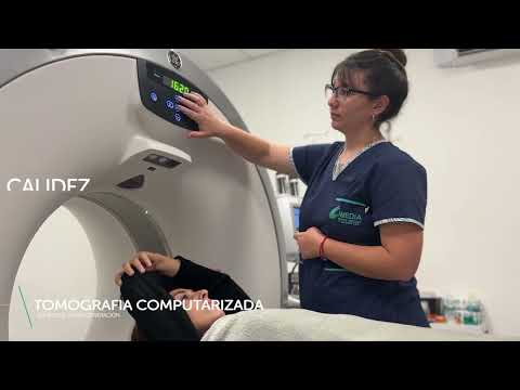 Tomografia Computada - Score de Calcio