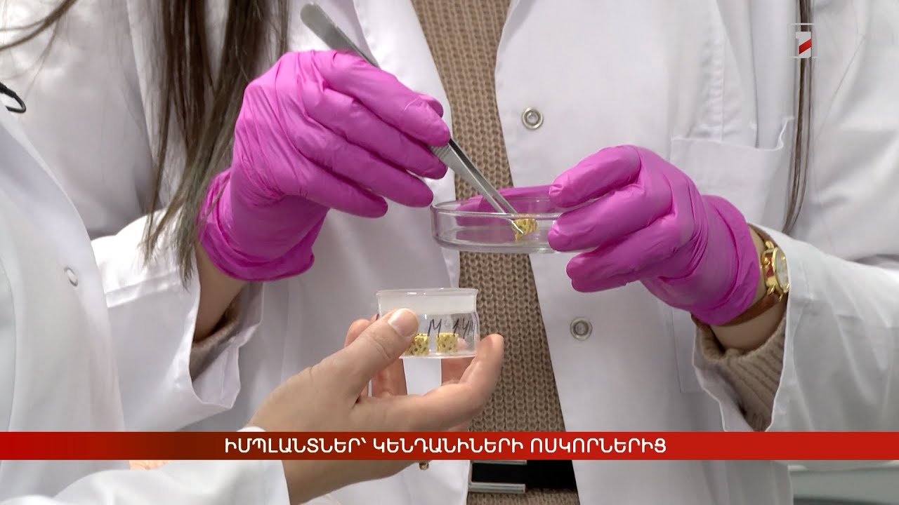 Իմպլանտներ՝ կենդանիների ոսկորներից