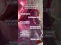 Https Youtube Com Shorts SOssZNzj1XM Si EnSIkaIECMiOmarE