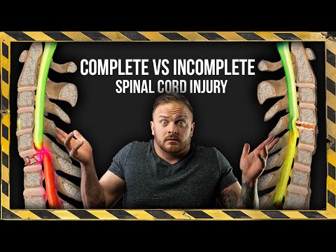 Complete VS Incomplete Spinal Cord Injury