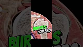✅¿Cómo se forma la bursitis del hombro?✅ #fisio #osteopatia #bursa #tendinitis #hombro