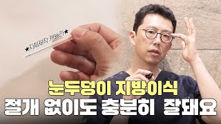 눈두덩이 지방이식할 때, 안와지방에 제대로 넣으려면 절개는 꼭 해야 한다던데... 진짜일까?