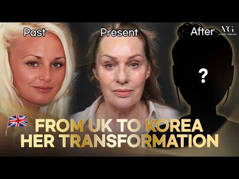 Why Sharon Chose VG Plastic Surgery Gangnam for Face and Neck Lift