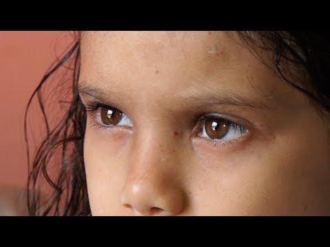 Menina de Bom Jardim tem doença rara e precisa de doação de medula óssea