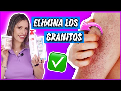 ELIMINA GRANITOS DE LOS BRAZOS SIGUIENDO ESTOS PASOS | QUERATOSIS PILARIS | NatyGloss