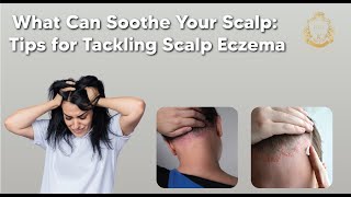 What Can Soothe Your Scalp: Tips for Tackling Scalp Eczema-Hair Center Of Turkey