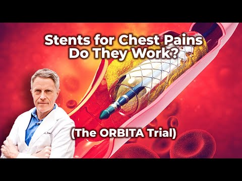 Stents for Chest Pains, Do They Work? (The ORBITA Trial)