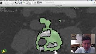 Segmentação da Aorta v2