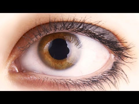 How to treat white bump on eye corner at home? - Dr.